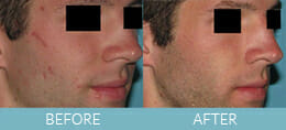 Laser / IPL Gallery