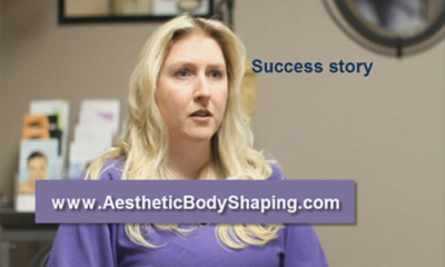 Dr. Miller – SmartLipo Patient Success Story